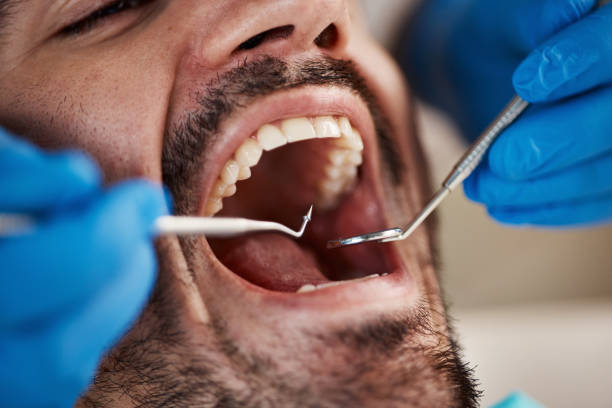 Best Emergency Tooth Extraction in Bronson, MI