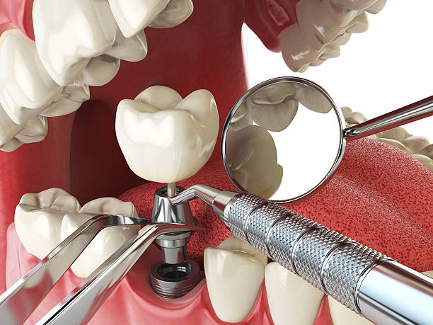 Best Urgent Care for Lost Fillings or Crowns in Bronson, MI